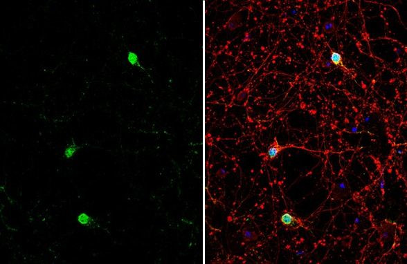 ETV1 Antibody in Immunocytochemistry (ICC/IF)