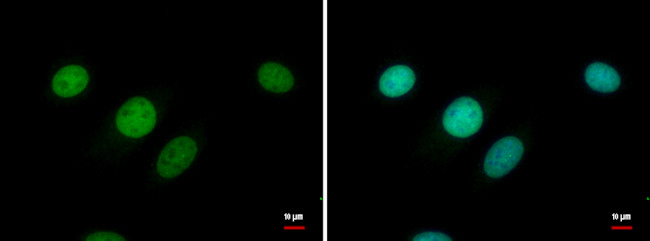 ETV1 Antibody in Immunocytochemistry (ICC/IF)