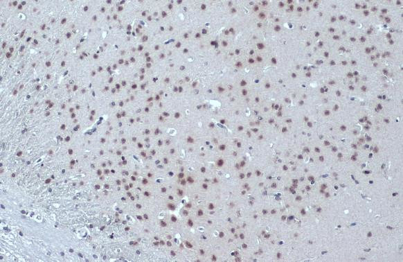 ETV1 Antibody in Immunohistochemistry (Paraffin) (IHC (P))