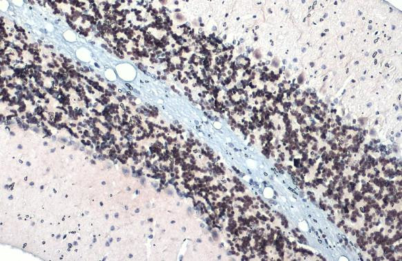 ETV1 Antibody in Immunohistochemistry (Paraffin) (IHC (P))