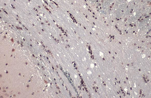 ETV1 Antibody in Immunohistochemistry (Paraffin) (IHC (P))