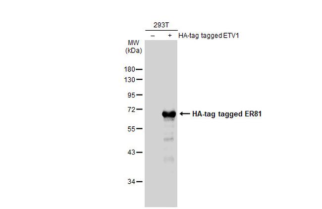 ETV1 Antibody in Western Blot (WB)