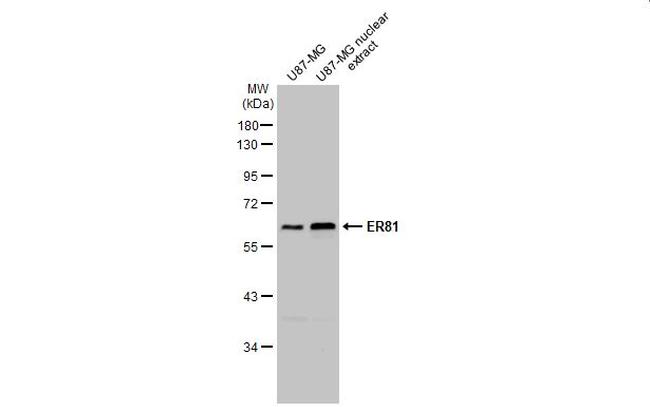 ETV1 Antibody in Western Blot (WB)