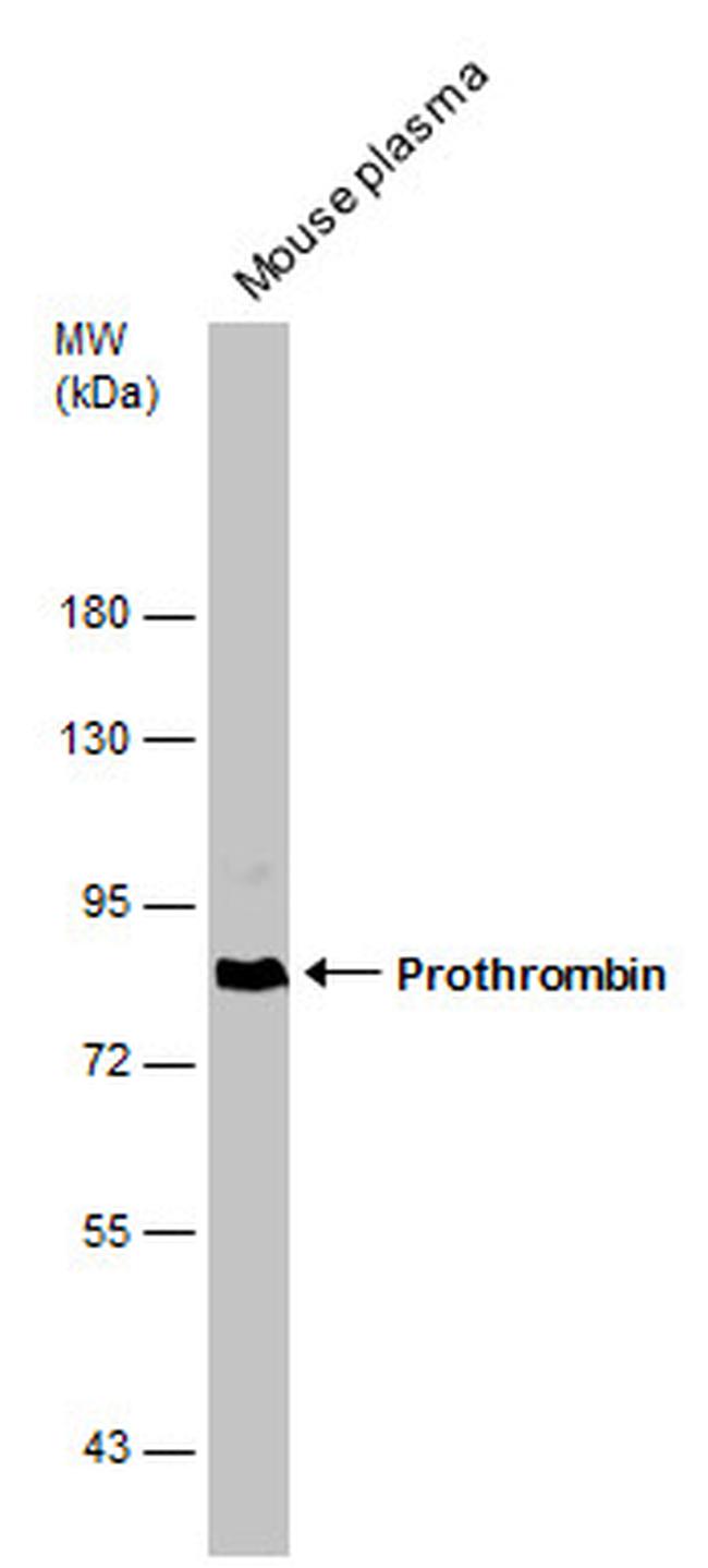 Prothrombin Antibody in Western Blot (WB)