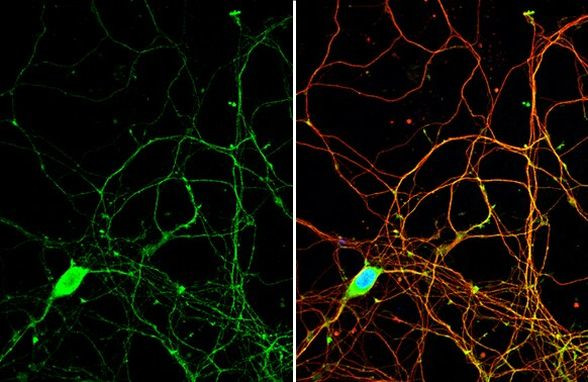 PYK2 Antibody in Immunocytochemistry (ICC/IF)