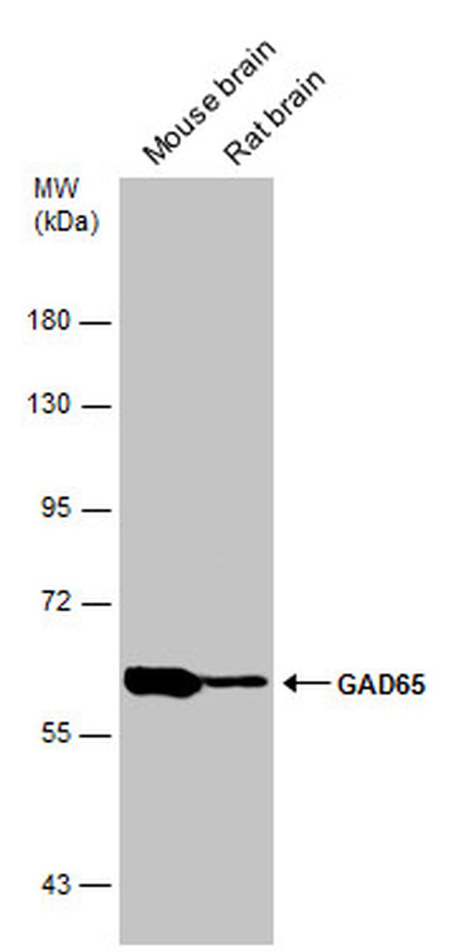 GAD65 Antibody in Western Blot (WB)