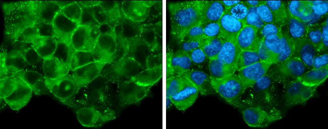 Glypican 3 Antibody in Immunocytochemistry (ICC/IF)