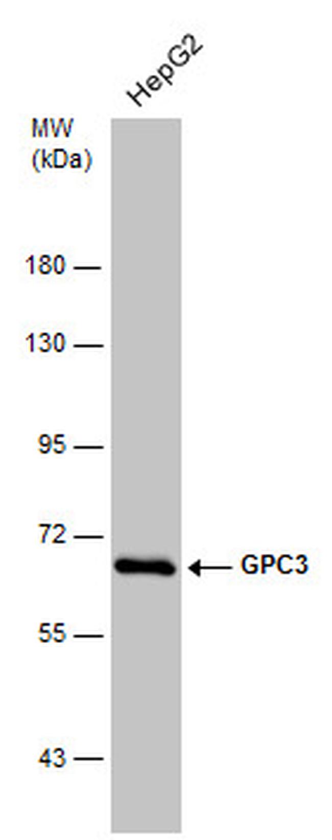 Glypican 3 Antibody in Western Blot (WB)