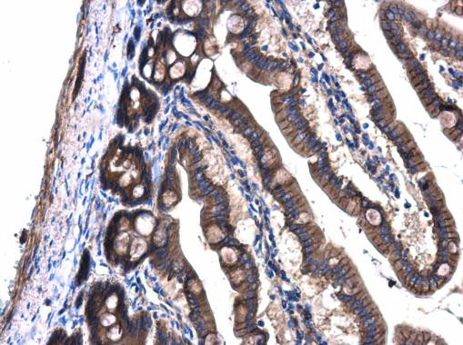 GNAQ Antibody in Immunohistochemistry (Paraffin) (IHC (P))