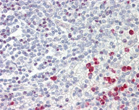 GNAQ Antibody in Immunohistochemistry (Paraffin) (IHC (P))