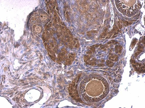 GNAQ Antibody in Immunohistochemistry (Paraffin) (IHC (P))