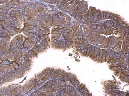 GNAQ Antibody in Immunohistochemistry (Paraffin) (IHC (P))