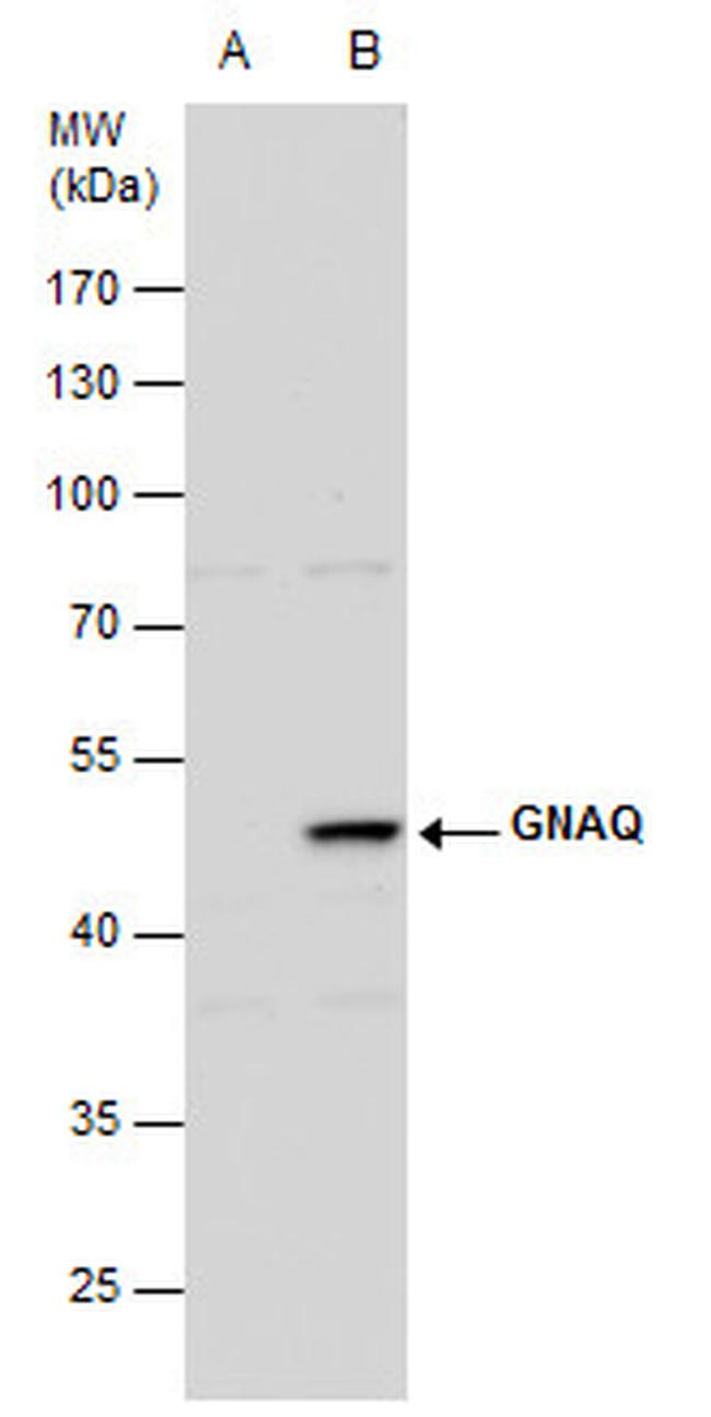 GNAQ Antibody in Western Blot (WB)