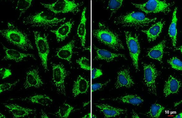 GOT2 Antibody in Immunocytochemistry (ICC/IF)