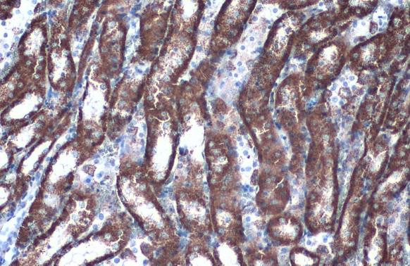 GOT2 Antibody in Immunohistochemistry (Paraffin) (IHC (P))