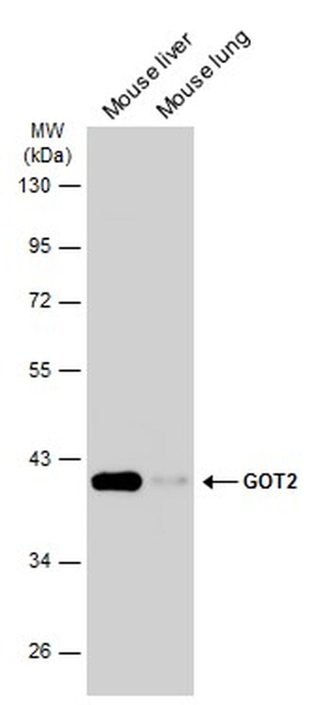 GOT2 Antibody in Western Blot (WB)