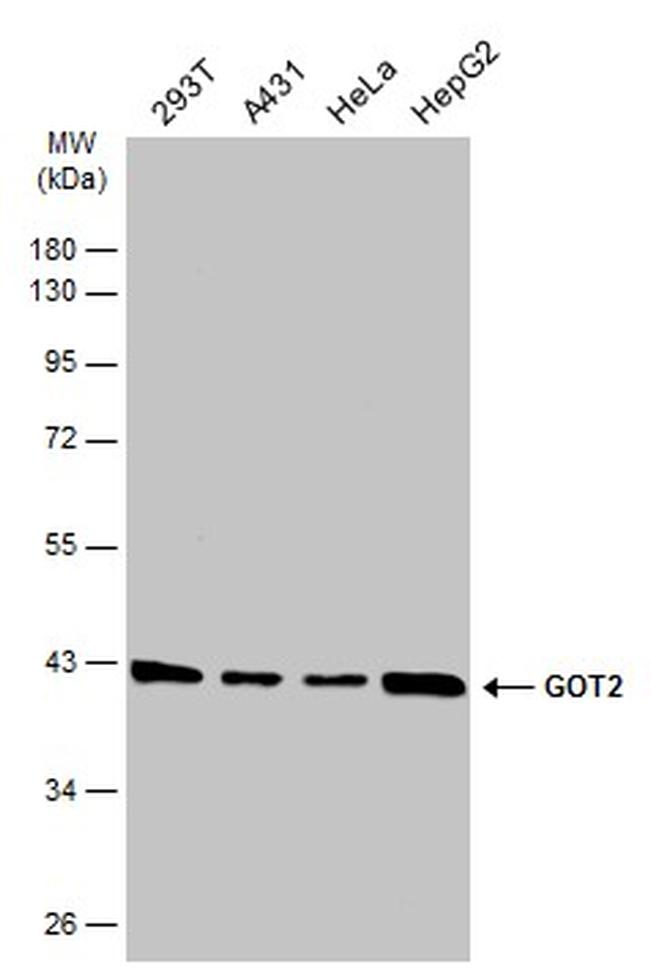 GOT2 Antibody in Western Blot (WB)