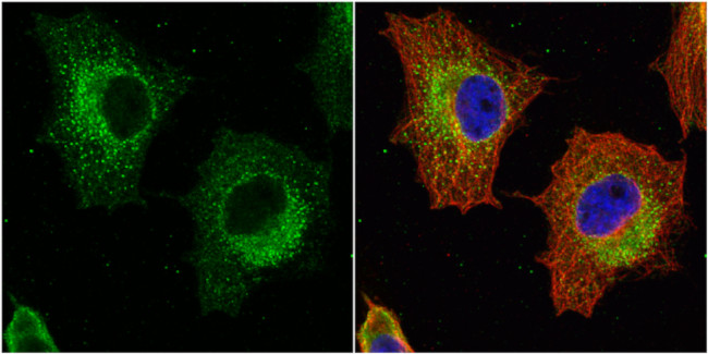 GSTP1 Antibody in Immunocytochemistry (ICC/IF)