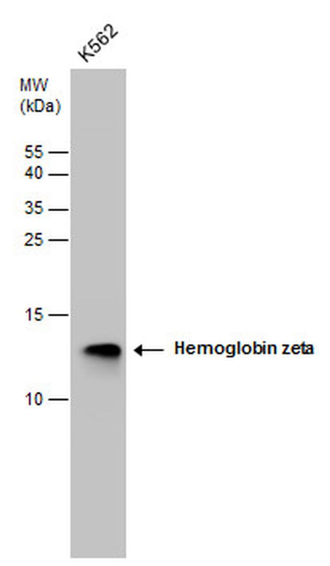 HBZ Antibody in Western Blot (WB)