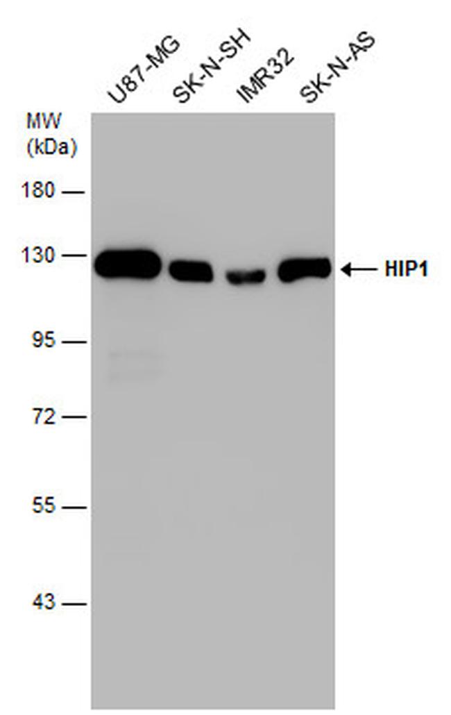 HIP1 Antibody in Western Blot (WB)