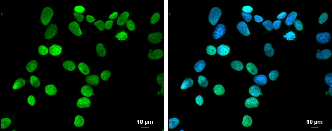 HMGA1 Antibody in Immunocytochemistry (ICC/IF)