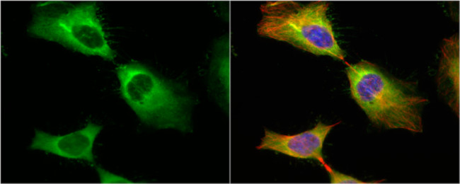 HSP27 Antibody in Immunocytochemistry (ICC/IF)