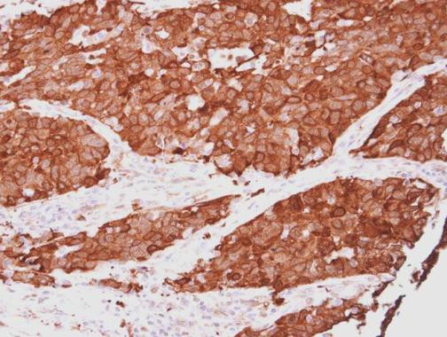 HSP27 Antibody in Immunohistochemistry (Paraffin) (IHC (P))