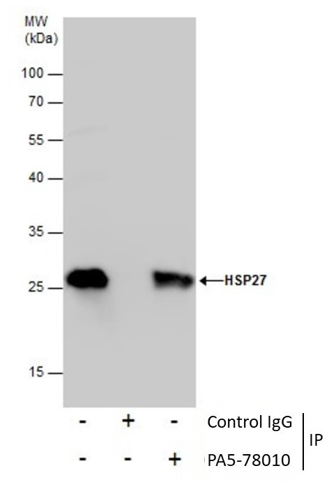 HSP27 Antibody in Immunoprecipitation (IP)