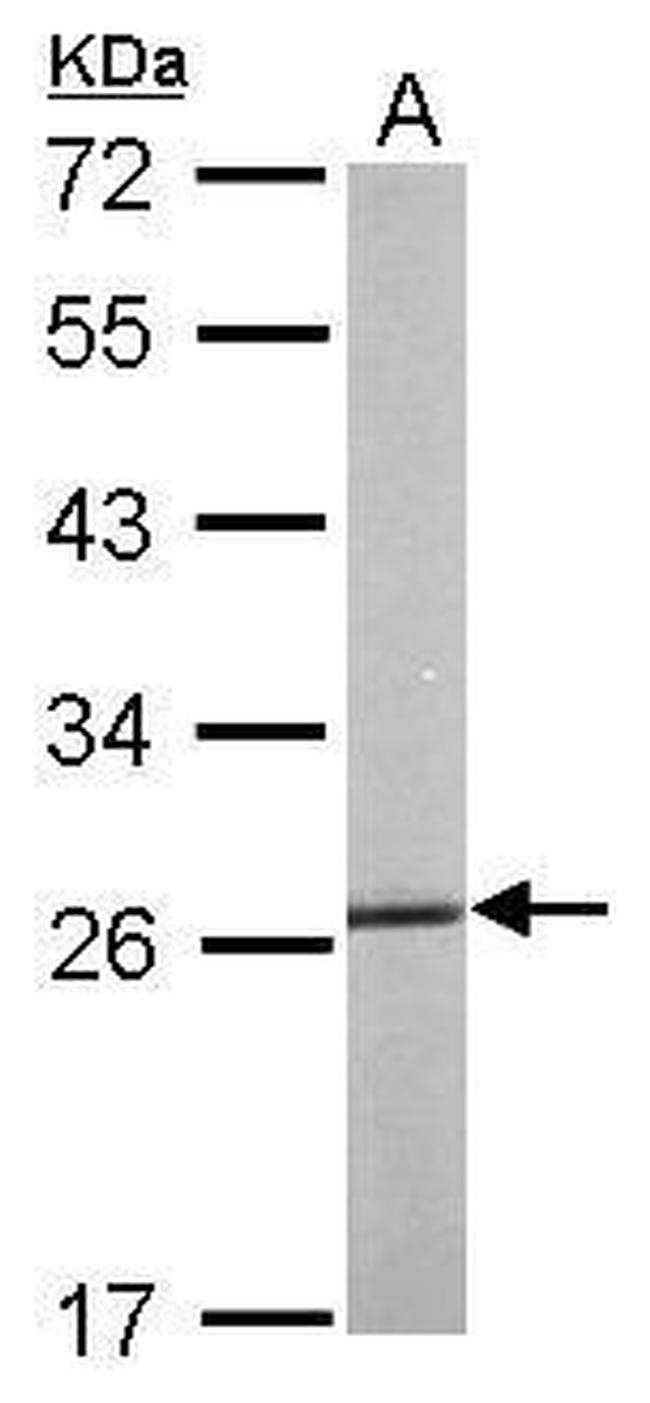 HSP27 Antibody in Western Blot (WB)