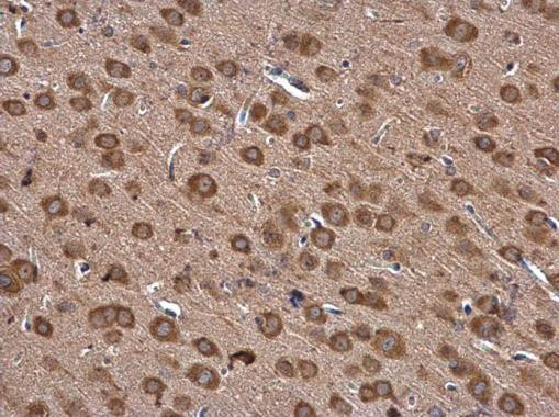 IARS Antibody in Immunohistochemistry (Paraffin) (IHC (P))