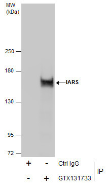 IARS Antibody in Immunoprecipitation (IP)