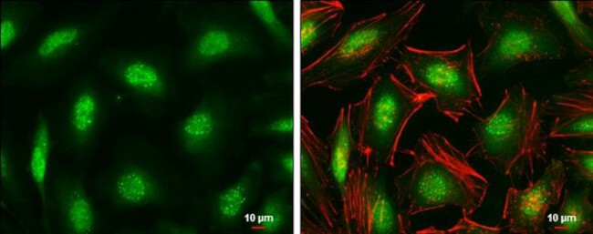 ID1 Antibody in Immunocytochemistry (ICC/IF)