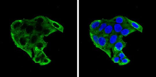 IGFBP-1 Antibody in Immunocytochemistry (ICC/IF)