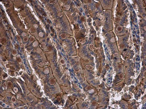 CYR61 Antibody in Immunohistochemistry (Paraffin) (IHC (P))