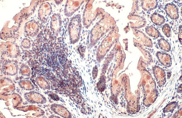 CYR61 Antibody in Immunohistochemistry (Paraffin) (IHC (P))