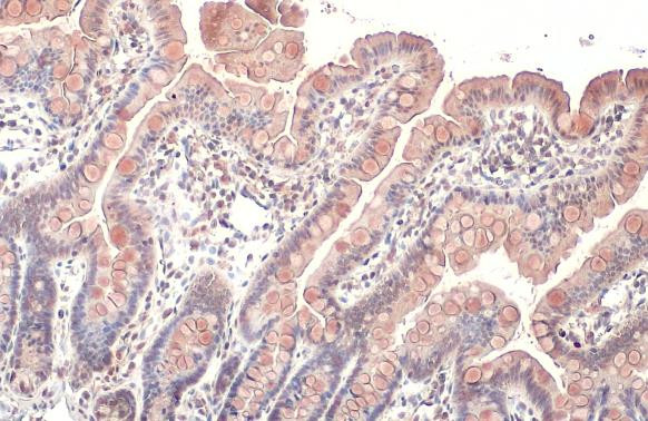 CYR61 Antibody in Immunohistochemistry (Paraffin) (IHC (P))