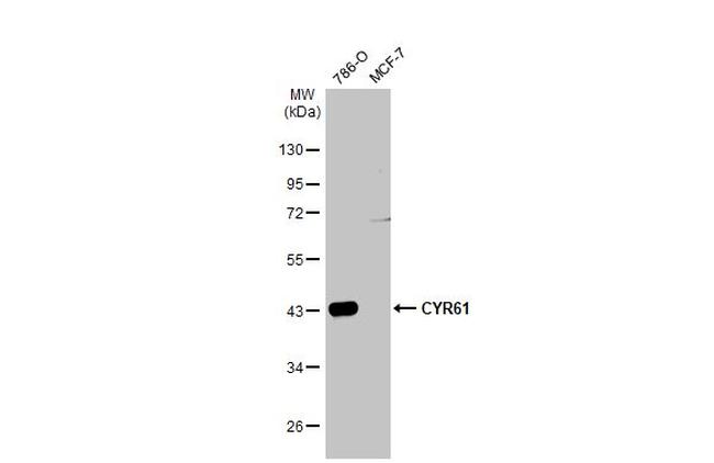 CYR61 Antibody in Western Blot (WB)