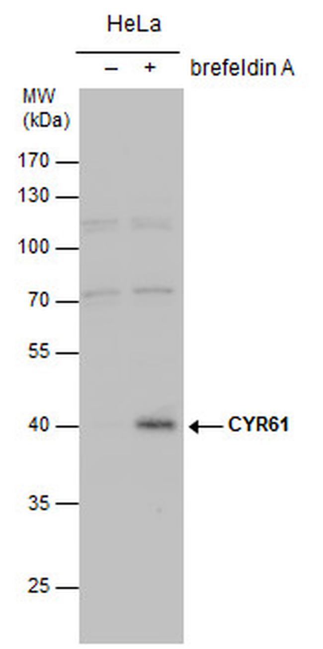 CYR61 Antibody in Western Blot (WB)