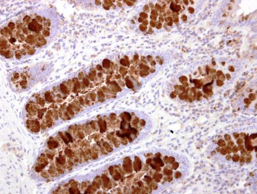 IL-16 Antibody in Immunohistochemistry (Paraffin) (IHC (P))