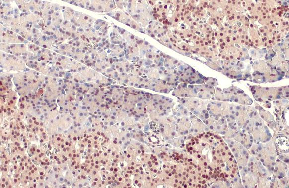 PDX1 Antibody in Immunohistochemistry (Paraffin) (IHC (P))