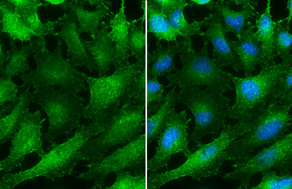 ITGB1 Antibody in Immunocytochemistry (ICC/IF)