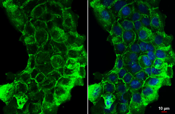 ITGB1 Antibody in Immunocytochemistry (ICC/IF)