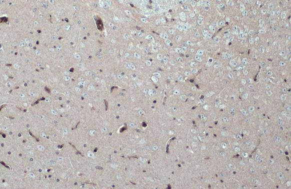 ITGB1 Antibody in Immunohistochemistry (Paraffin) (IHC (P))