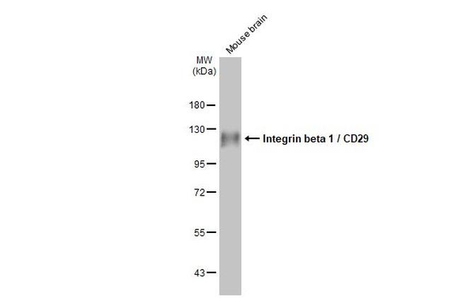 ITGB1 Antibody in Western Blot (WB)