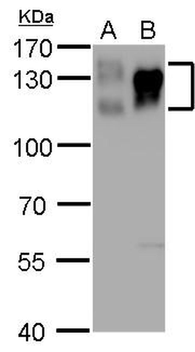 ITGB1 Antibody in Western Blot (WB)