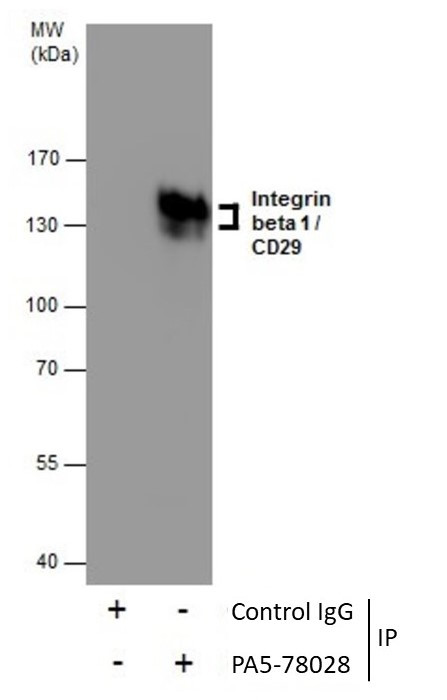 ITGB1 Antibody in Immunoprecipitation (IP)