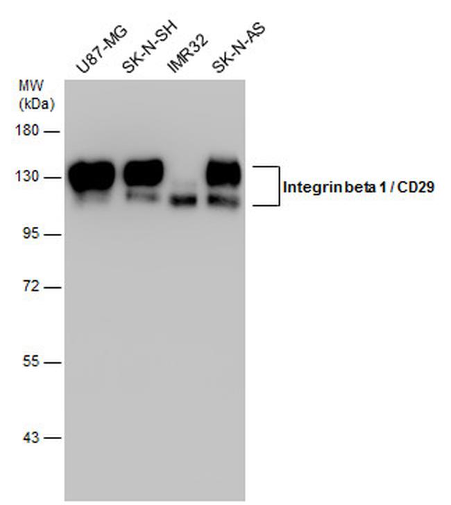 ITGB1 Antibody in Western Blot (WB)