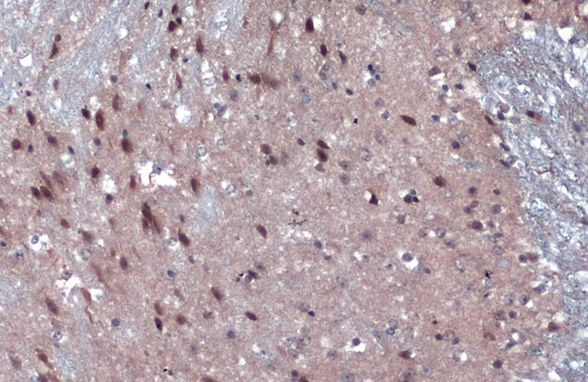 JARID2 Antibody in Immunohistochemistry (Paraffin) (IHC (P))