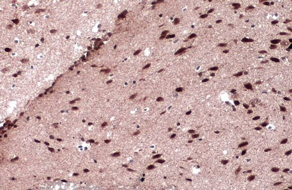 JARID2 Antibody in Immunohistochemistry (Paraffin) (IHC (P))