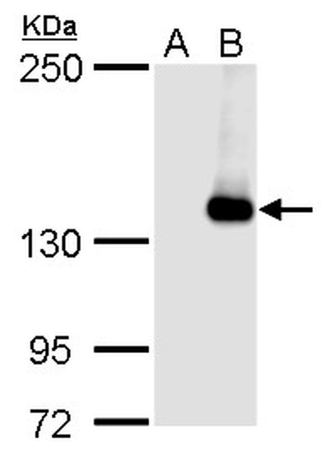 JARID2 Antibody in Western Blot (WB)